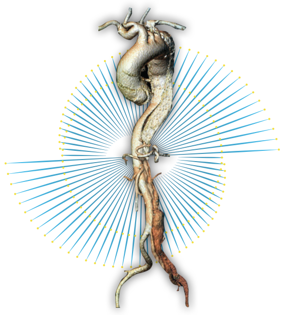 aorta-back-2
